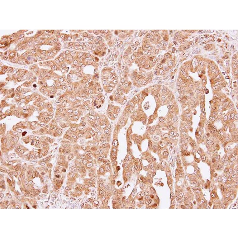 Immunohistochemistry - HPRT antibody from Signalway Antibody (23019) - Antibodies.com