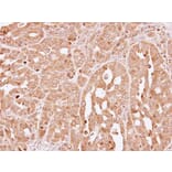 Immunohistochemistry - HPRT antibody from Signalway Antibody (23019) - Antibodies.com