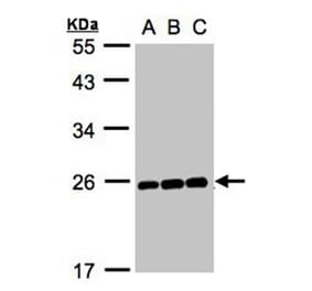 MAD2 antibody from Signalway Antibody (23040) - Antibodies.com