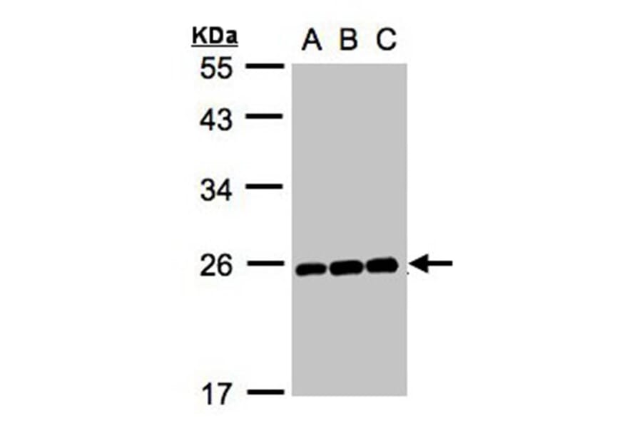 MAD2 antibody from Signalway Antibody (23040) - Antibodies.com