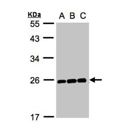 MAD2 antibody from Signalway Antibody (23040) - Antibodies.com