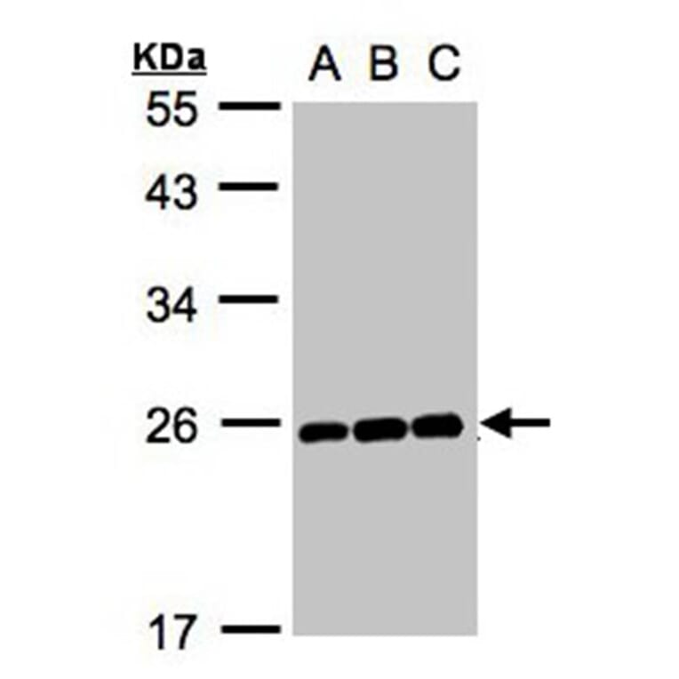 MAD2 antibody from Signalway Antibody (23040) - Antibodies.com