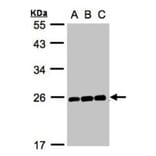 MAD2 antibody from Signalway Antibody (23040) - Antibodies.com