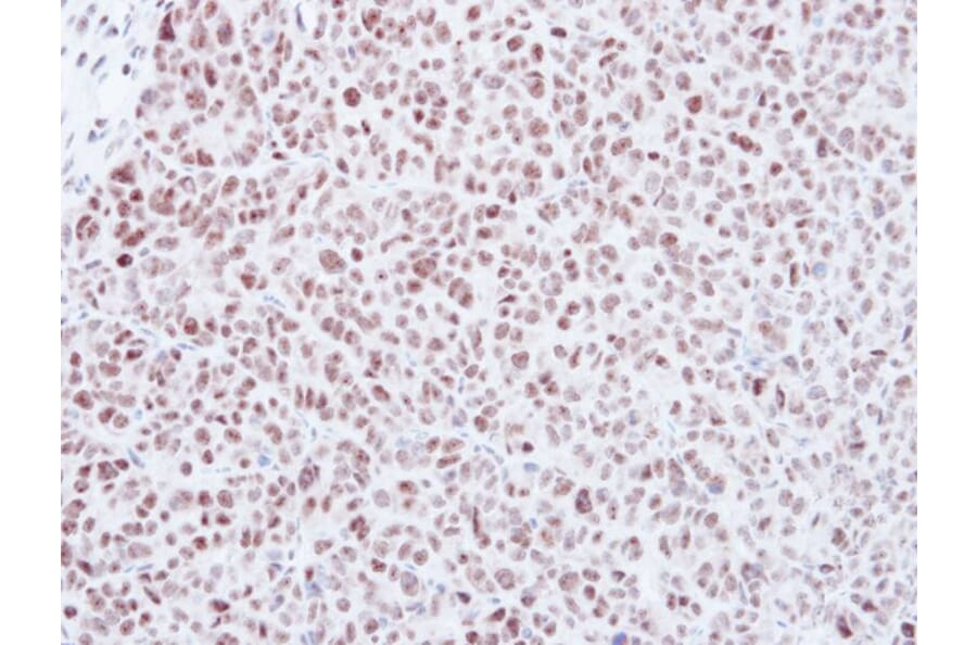 Immunohistochemistry - MAD2 antibody from Signalway Antibody (23040) - Antibodies.com