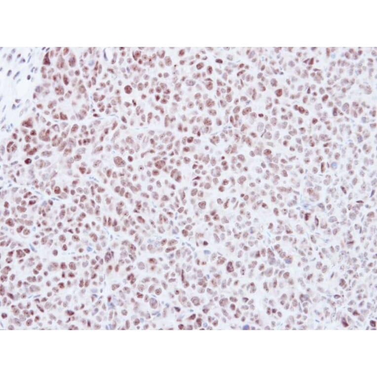 Immunohistochemistry - MAD2 antibody from Signalway Antibody (23040) - Antibodies.com