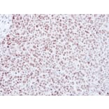 Immunohistochemistry - MAD2 antibody from Signalway Antibody (23040) - Antibodies.com