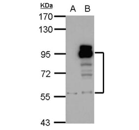 PDE4D antibody from Signalway Antibody (23049) - Antibodies.com