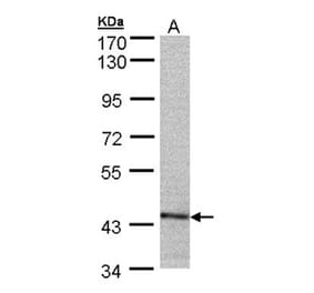 PSMC6 antibody from Signalway Antibody (23063) - Antibodies.com