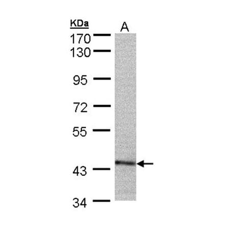 PSMC6 antibody from Signalway Antibody (23063) - Antibodies.com