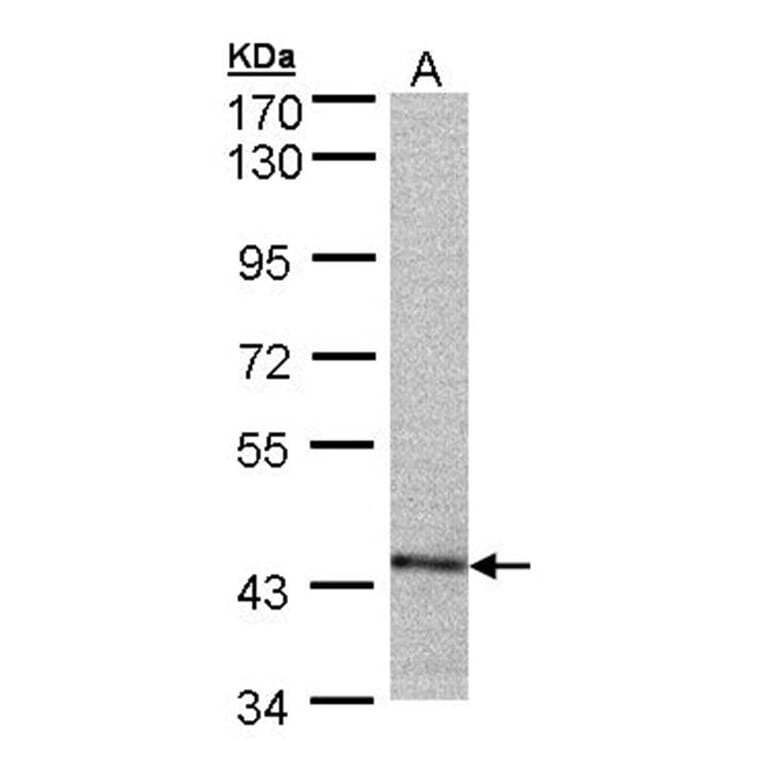 PSMC6 antibody from Signalway Antibody (23063) - Antibodies.com