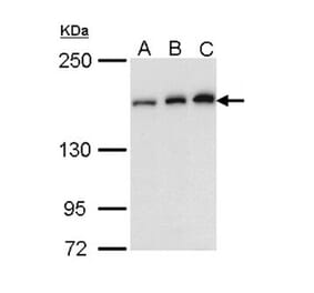 ROCK1 antibody from Signalway Antibody (23068) - Antibodies.com