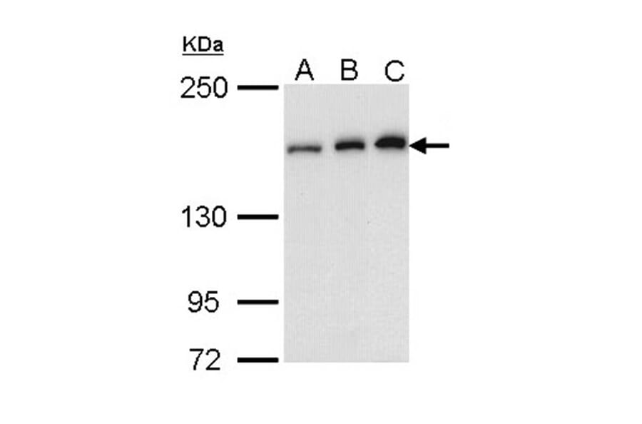 ROCK1 antibody from Signalway Antibody (23068) - Antibodies.com