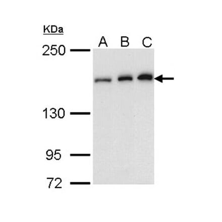 ROCK1 antibody from Signalway Antibody (23068) - Antibodies.com