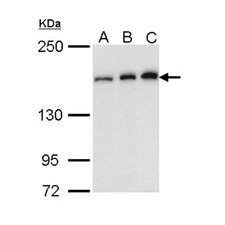 ROCK1 antibody from Signalway Antibody (23068) - Antibodies.com
