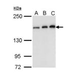 ROCK1 antibody from Signalway Antibody (23068) - Antibodies.com