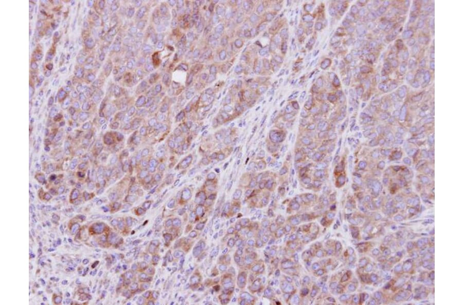 Immunohistochemistry - ROCK1 antibody from Signalway Antibody (23068) - Antibodies.com
