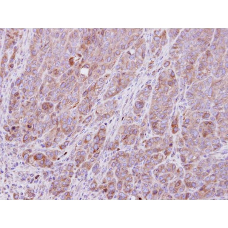 Immunohistochemistry - ROCK1 antibody from Signalway Antibody (23068) - Antibodies.com