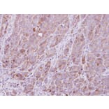 Immunohistochemistry - ROCK1 antibody from Signalway Antibody (23068) - Antibodies.com