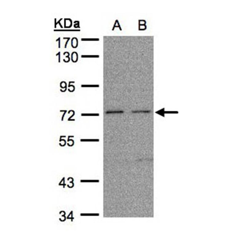 FLRT1 antibody from Signalway Antibody (23122) - Antibodies.com