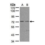 FLRT1 antibody from Signalway Antibody (23122) - Antibodies.com