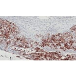 Immunohistochemistry - FLRT1 antibody from Signalway Antibody (23122) - Antibodies.com