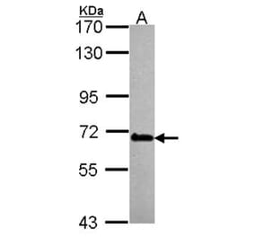 DDX56 antibody from Signalway Antibody (23132) - Antibodies.com