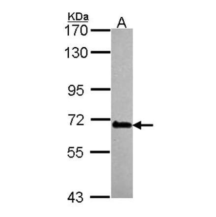 DDX56 antibody from Signalway Antibody (23132) - Antibodies.com