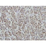 Immunohistochemistry - DDX56 antibody from Signalway Antibody (23132) - Antibodies.com