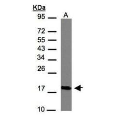 CMTM6 antibody from Signalway Antibody (23134) - Antibodies.com