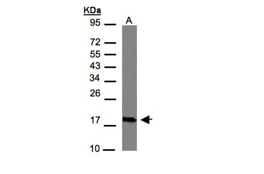 CMTM6 antibody from Signalway Antibody (23134) - Antibodies.com