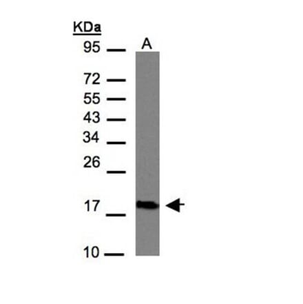 CMTM6 antibody from Signalway Antibody (23134) - Antibodies.com