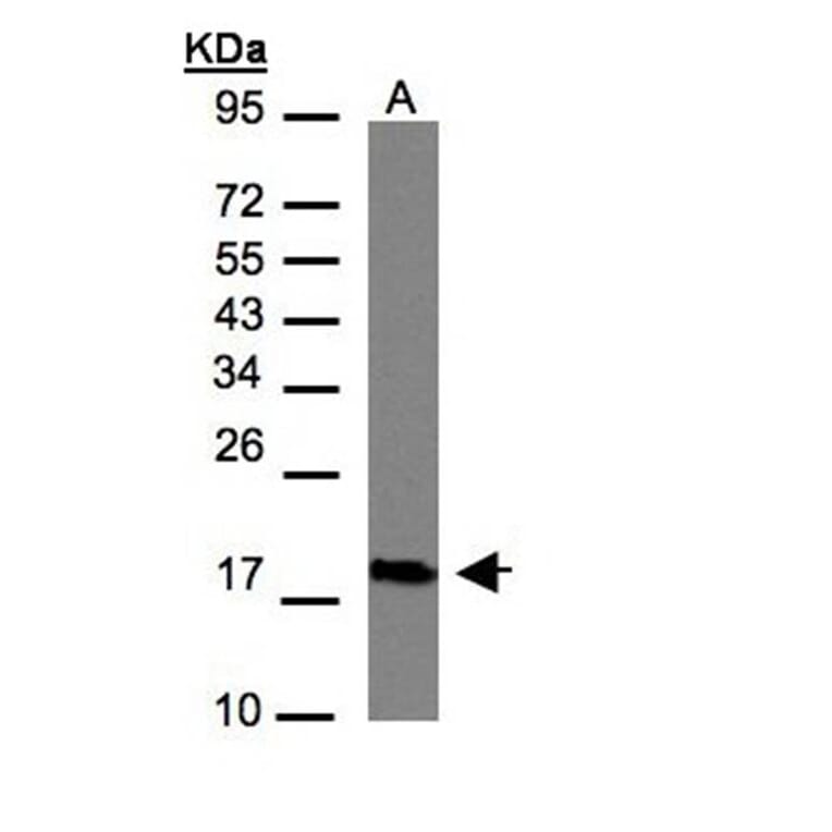 CMTM6 antibody from Signalway Antibody (23134) - Antibodies.com