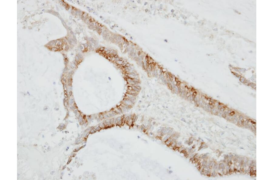 Immunohistochemistry - CMTM6 antibody from Signalway Antibody (23134) - Antibodies.com