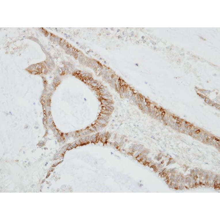 Immunohistochemistry - CMTM6 antibody from Signalway Antibody (23134) - Antibodies.com