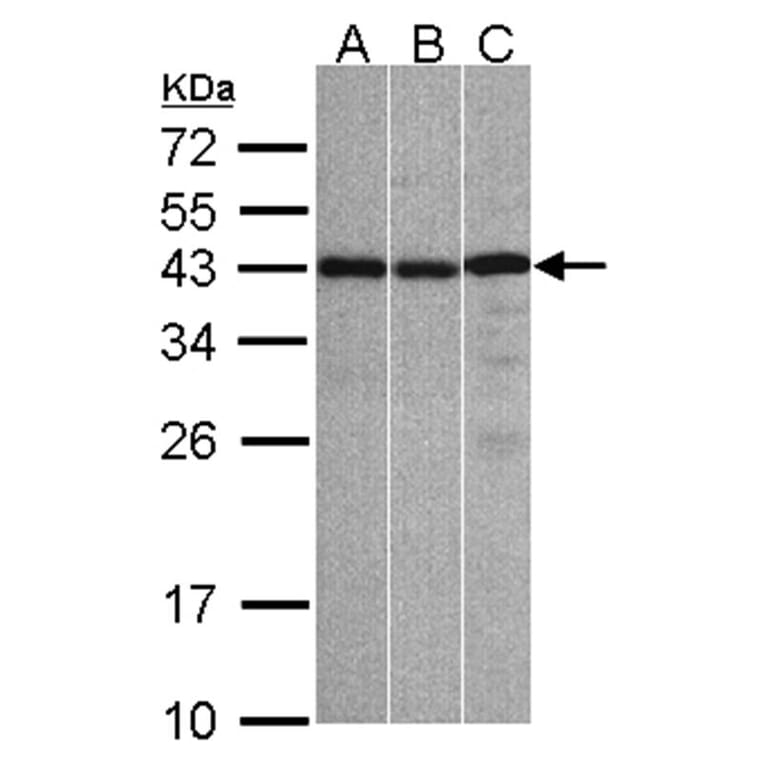 ZC3H8 antibody from Signalway Antibody (23160) - Antibodies.com