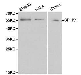 Western blot - SPHK1 Antibody from Signalway Antibody (32004) - Antibodies.com
