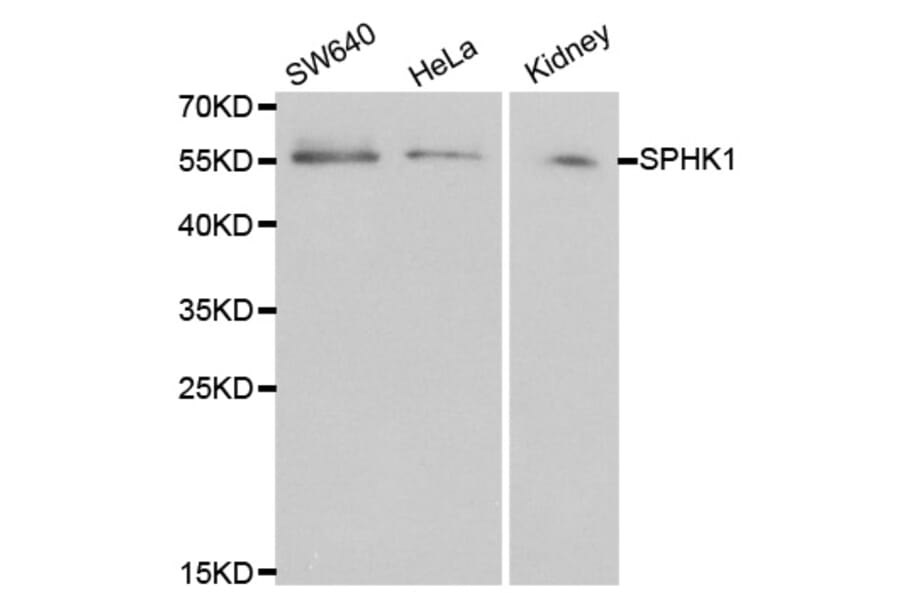 Western blot - SPHK1 Antibody from Signalway Antibody (32004) - Antibodies.com