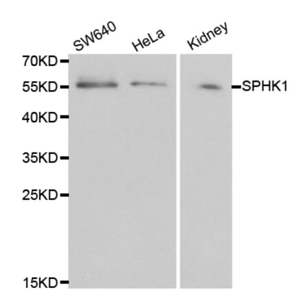 Western blot - SPHK1 Antibody from Signalway Antibody (32004) - Antibodies.com