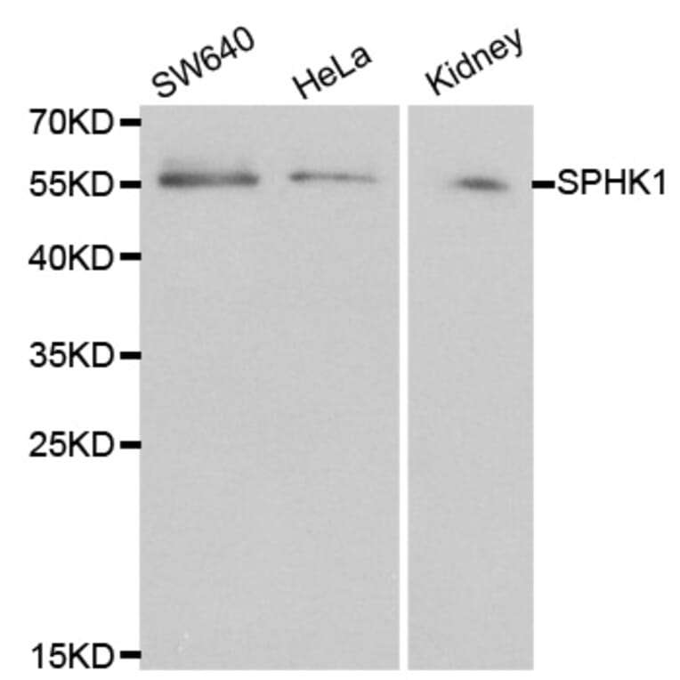 Western blot - SPHK1 Antibody from Signalway Antibody (32004) - Antibodies.com