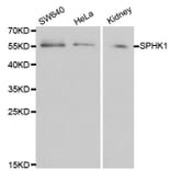 Western blot - SPHK1 Antibody from Signalway Antibody (32004) - Antibodies.com