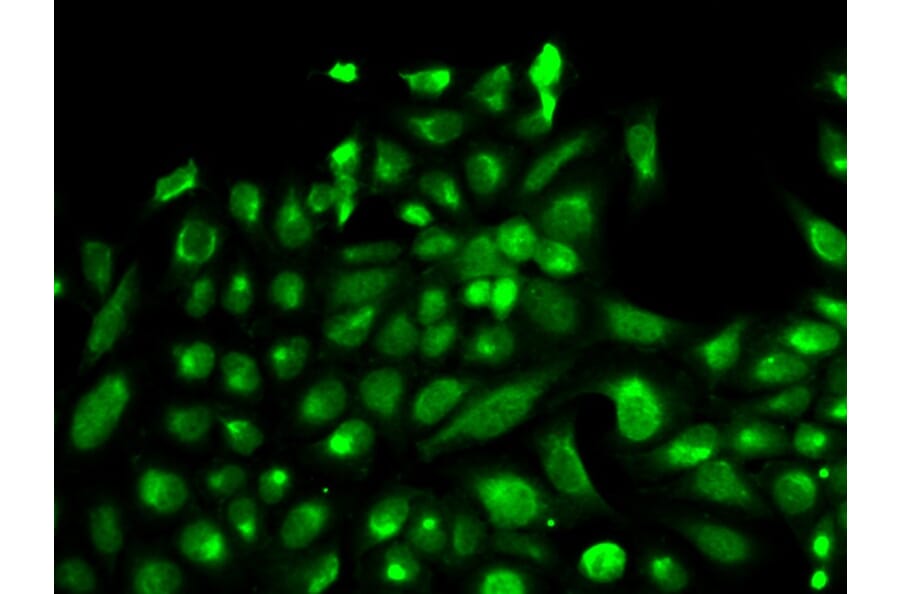 Immunofluorescence - SPHK1 Antibody from Signalway Antibody (32004) - Antibodies.com