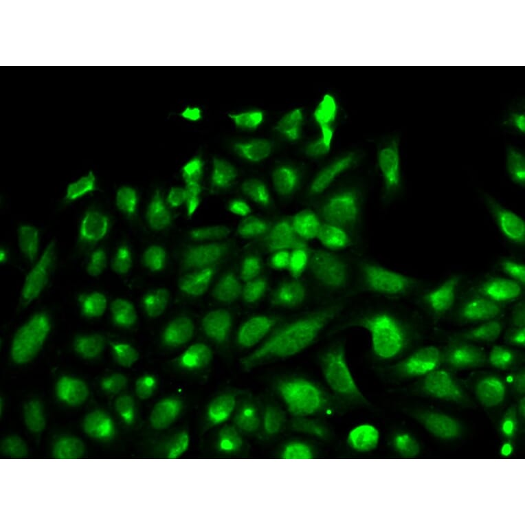 Immunofluorescence - SPHK1 Antibody from Signalway Antibody (32004) - Antibodies.com