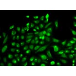 Immunofluorescence - SPHK1 Antibody from Signalway Antibody (32004) - Antibodies.com