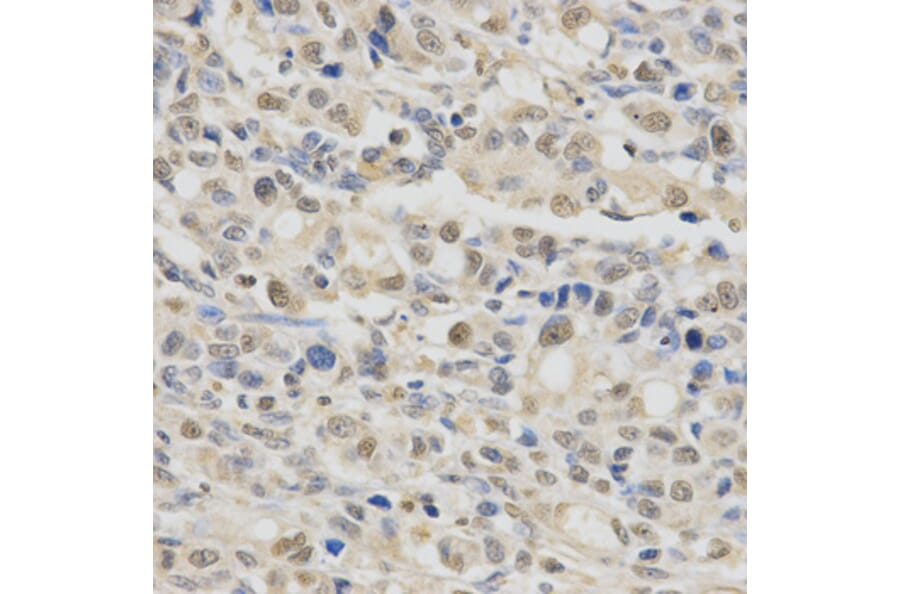 Immunohistochemistry - SPHK1 Antibody from Signalway Antibody (32004) - Antibodies.com