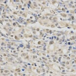 Immunohistochemistry - SPHK1 Antibody from Signalway Antibody (32004) - Antibodies.com