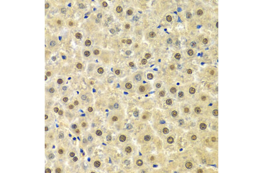 Immunohistochemistry - SPHK1 Antibody from Signalway Antibody (32004) - Antibodies.com