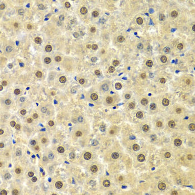 Immunohistochemistry - SPHK1 Antibody from Signalway Antibody (32004) - Antibodies.com