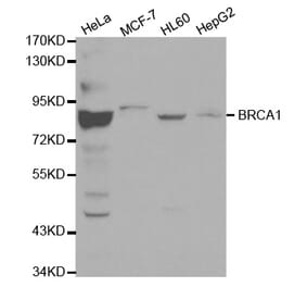 Western blot - BRCA1 Antibody from Signalway Antibody (32016) - Antibodies.com
