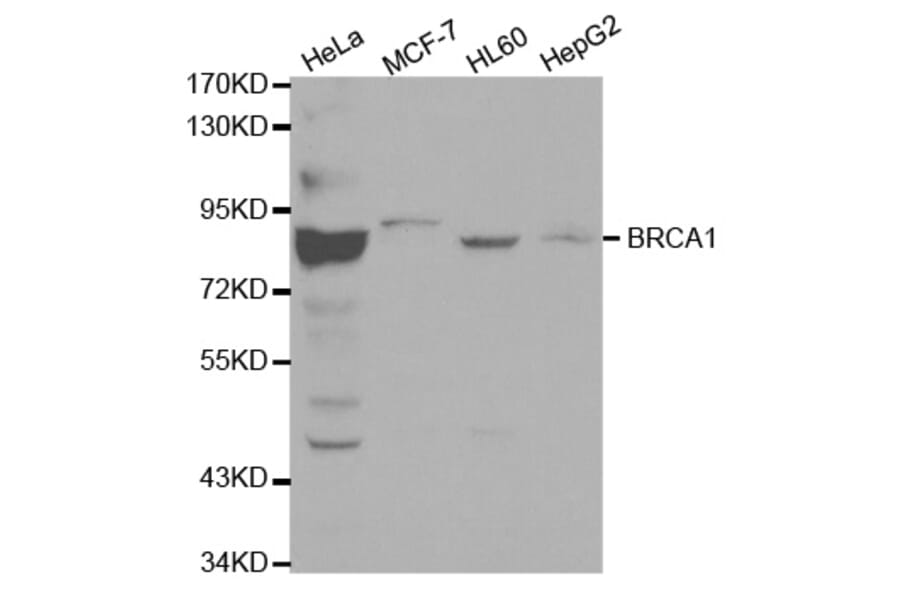 Western blot - BRCA1 Antibody from Signalway Antibody (32016) - Antibodies.com