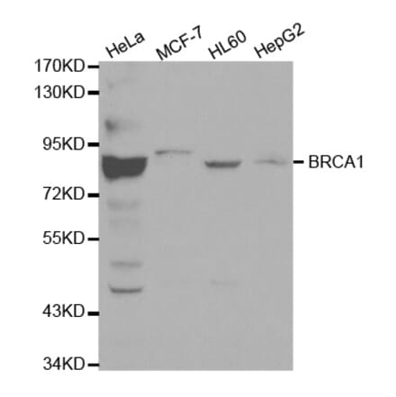 Western blot - BRCA1 Antibody from Signalway Antibody (32016) - Antibodies.com